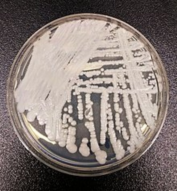 Candida auris, il fungo che preoccupa il mondo
